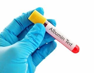 Albumin, Serum Albumin, Serum