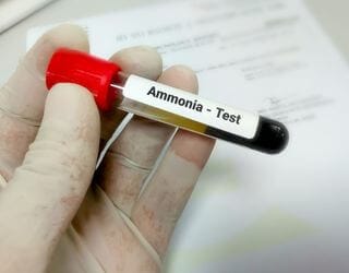 Ammonia, Blood Ammonia, Blood