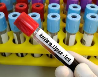 Amylase, Serum Amylase, Serum
