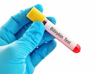 Bilirubin, Direct Bilirubin, Direct