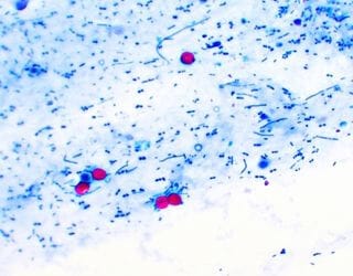 Blood Smear - Protozoa Blood Smear - Protozoa