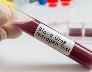 Blood Urea Nitrogen (BUN) urea, Serum