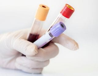Canine Anaplasma Detection, PCR Canine Anaplasma Detection, PCR