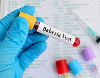 Canine Babesia Detection, PCR Canine Babesia Detection, PCR