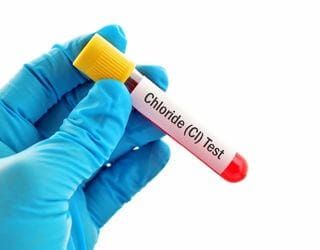 Chloride, Serum Chloride, Serum