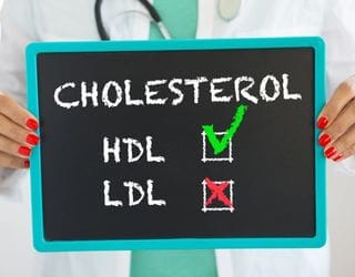 Cholesterol, HDL Cholesterol, HDL