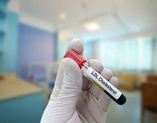 Cholesterol, LDL Cholesterol, LDL
