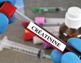 Creatinine, Serum Creatinine, Serum