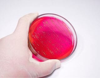 Culture Blood and Sensitivity (Aerobic) Culture Blood and Sensitivity (Aerobic)