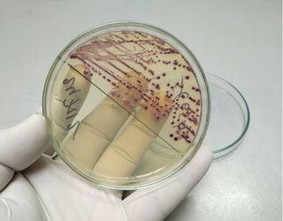 Culture Urine and Sensitivity Culture Urine and Sensitivity