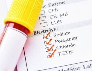 Electrolytes, Serum (Sodium, Potassium, Chloride) Electrolytes, Serum (Sodium, Potassium, Chloride)
