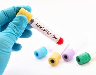 Estradiol (E2) Estradiol (E2)