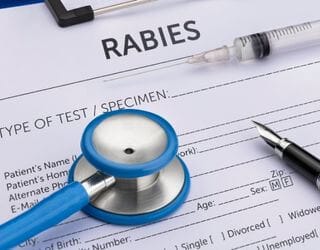 FAVN TEST(RABIES ANTIBODY TITER) FOR OVERSEAS TRAVEL FAVN TEST(RABIES ANTIBODY TITER) FOR OVERSEAS TRAVEL