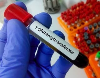 Gamma Glutamyl Transpeptidase (GGT) Gamma Glutamyl Transpeptidase (GGT)