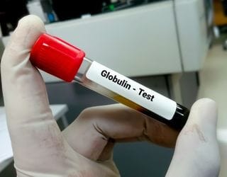 Globulin, Serum Globulin, Serum