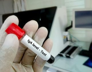 IgA Immunoglobulin, Serum IgA Immunoglobulin, Serum