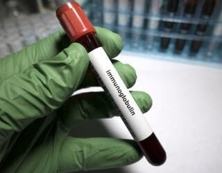 IgM Immunoglobulin, Serum IgM Immunoglobulin, Serum