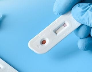 Leishmania Antibody IgG Leishmania Antibody IgG