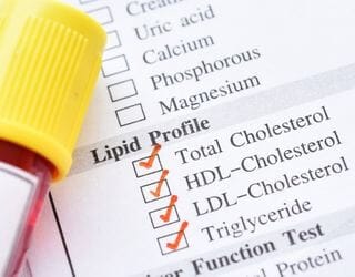 Lipid Profile Lipid Profile