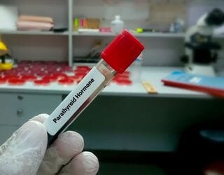 Parathyroid Hormone (PTH) Parathyroid Hormone (PTH)