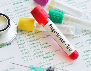 Progesterone, Serum Progesterone, Serum