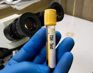 TSH (Thyroid-Stimulating Hormone) TSH (Thyroid-Stimulating Hormone)