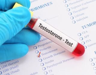 Testosterone, Serum Testosterone, Serum
