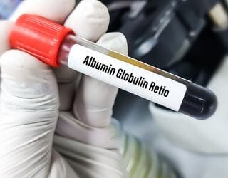 Total Protein, Serum (Albumin, Globulin, A_G Ratio) Total Protein, Serum (Albumin, Globulin, A_G Ratio)