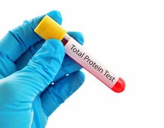 Total Protein, Serum Total Protein, Serum