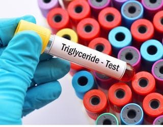 Triglycerides, Serum Triglycerides, Serum