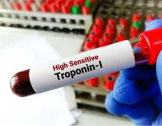 Troponin I Troponin I