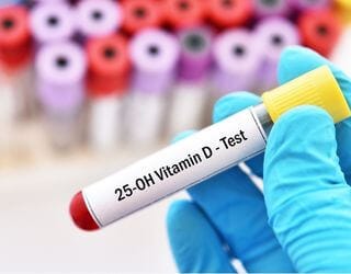 Vitamin D, 25 Hydroxy Vitamin D, 25 Hydroxy